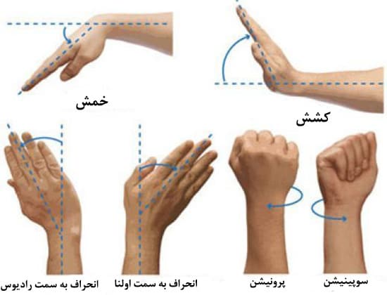 درمان مچ درد با روش های طب فیزیکی