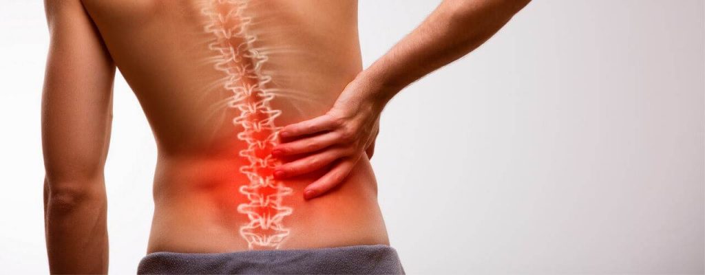 درمان فتق دیسک (بیرون زدگی دیسک) بعلت فشار زیاد بر ستون فقرات