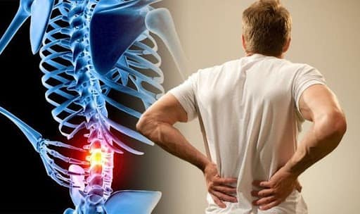 علل درد پایین کمر تقویت عضلات و کاهش درد در پایین کمر و دنبالچه
