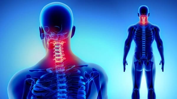 فرق دیسک گردن با آرتروز گردن چیست